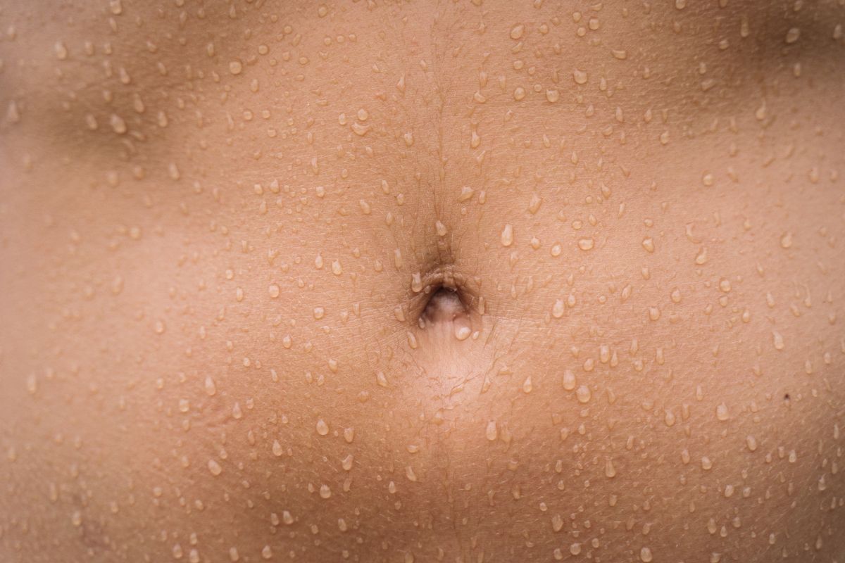 Close-up of abdomen skin texture — stock placeholder, not an actual patient photo